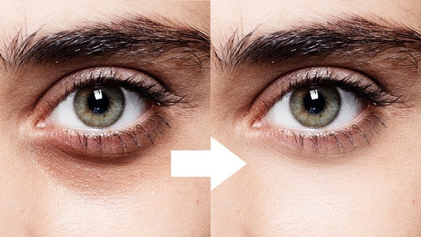 Remove dark circles under the eyes with Eye Mask